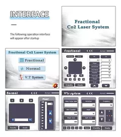 LASER FRACIONADO CO2 COM RADIOFREQUÊNCIA (RF) – 3 EM 1 | TRATAMENTO ESTÉTICO PROFISSIONAL - comprar online