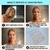 Adesivos Anti Rugas para Rosto Modelo:9 Peças