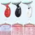 Imagem do LumiLift – Massageador Facial com Lifting e LED Terapia
