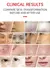 Imagem do DH Beauty – Dispositivo de Spray Facial com LED Rejuvenescedor | Cuidados Completos para Sua Pele