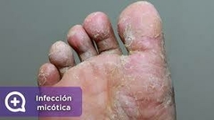 Banner de la categoría MEDICAMENTOS PARA EL HONGO