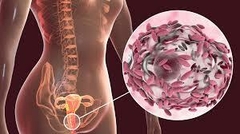 Banner de la categoría MEDICAMENTOS PARA USO VAGINAL