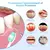 Limpador de dentes elétrico,remove tártaro raspador dental - loja online