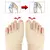 JoanetePro - corretor de Joanetes - RomaStore