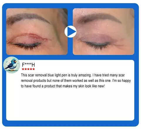 Reparação de cicatrizes de pele