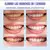 OFERTA 2X1 - BLANQUEADOR WHITELIGHT PRO - tienda online