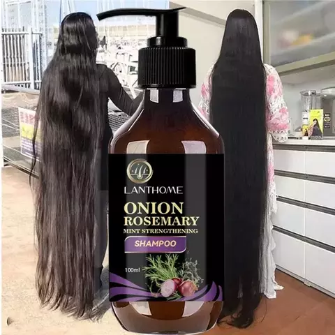 Shampoo para crescimento rápido do cabelo, alecrim, cebola, shampoo para cresci