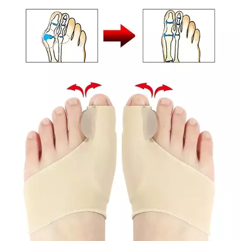 2 peças separador de dedo do pé hálux valgus joanete corretor ortopédico pé