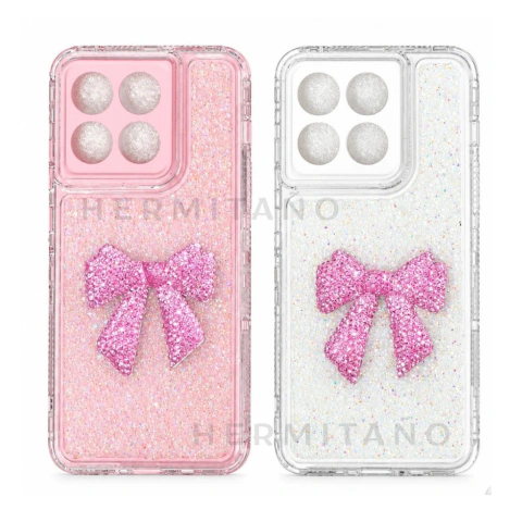 CASE MOÑO 360