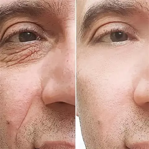 Retinol creme anti-rugas para homens colágeno anti-envelhecimento remoção de