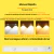 Kit Luminária Led Sensor Presença Dimerizável Controle 30cm