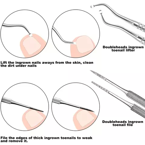 Conjunto de lixa e levantadores de unhas encravadas 6/7 em 1, kit de remoção.