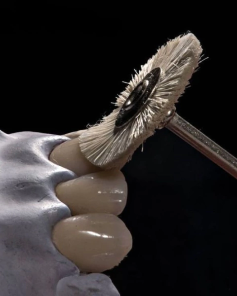 Manutenção Facetas em Porcelana