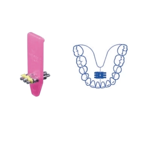 Tornillos De Expansión Estándar - comprar online