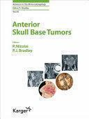 Anterior Skull Base Tumors