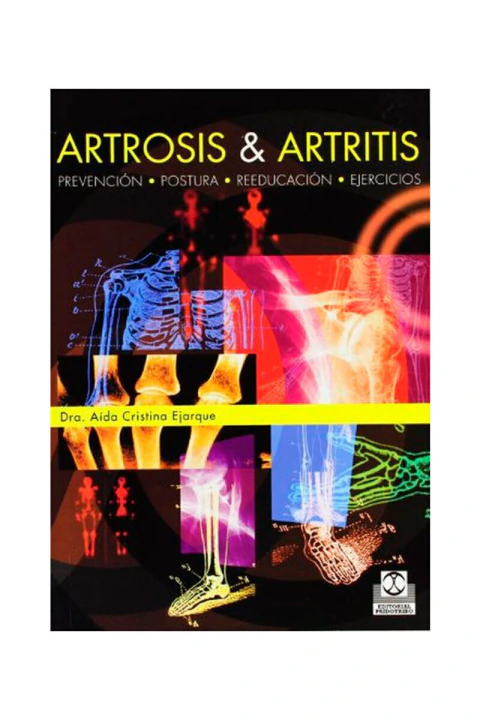 ARTROSIS Y ARTRITIS