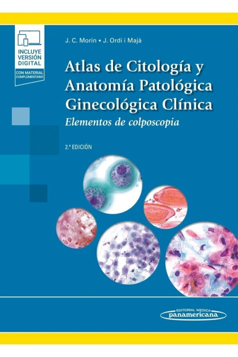 Atlas de Citología y Anatomía Patológica Ginecológica Clínica 2a ED. +E