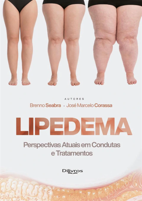 Lipedema Perspectivas Atuais Em Condutas E Tratamentos