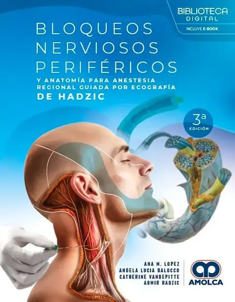 Bloqueos Nerviosos Perifericos y Anatomia para Anestesia Regonal Guiada por Ecografia de Hadzic