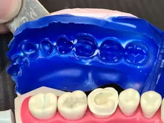 Silicona Dental C+silicona Combo Putty+light+acti Densell (1080) en internet