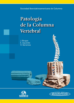 PATOLOGIA DE LA COLUMNA VERTEBRAL SILACO