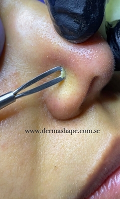 Circuito 3 hs Corporal y Facial con Dermopulido + Limpieza de Cutis + Tratamiento para Piernas - Dermashape Limpieza Facial en Palermo
