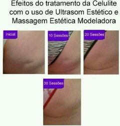 Ultrasson Drenagem linfática Corrente Russa Pré e Pós Operatório - Bela Estética 