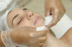 Limpeza de Pele + Peeling Diamante - Bela Estética 