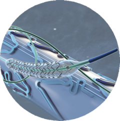 STENT CORONARIO L/ RAPAMICINA MICRO PORT 2.50 x 13 - comprar online