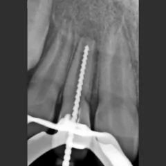 SAEVO DIGITAL SENSOR 1 - comprar online