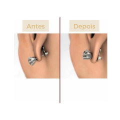 Imagem do Tarraxa mágica sustentação coração pequena