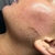 Dermaplanning Facial Premium - comprar online