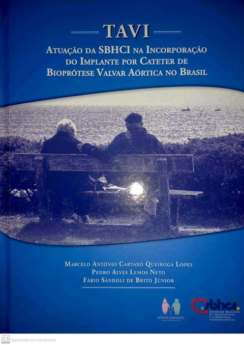 Tavi Atuação Da Sbhci Na Incorporação Do ImplanteTavi Atuação Da Sbhci Na Incorporação Do Implante