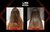 LISS EXPERT ACOND X 250