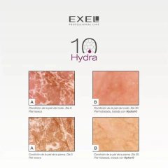 Hydra 10 Emulsión Dermoprotectora Piel con Diabetes 250ml Exel en internet
