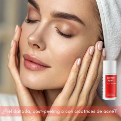 Barrier Repair Crema Reparadora Post Peeling x45g Niza en internet