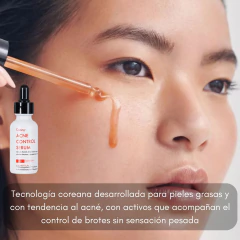 Acne Control Serum 30ml Coony - Zafirus