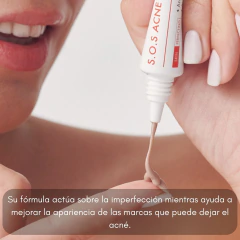 Tratamiento Antiacne SOS Spot 15ml Coony - Zafirus