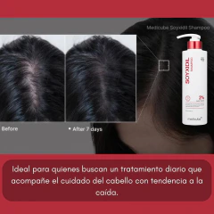 Soyxidil Shampoo 2% Anticaida 490ml Medicube - Zafirus