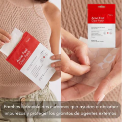 Acné Fast Clear Patch Parches Antiacne 24u Coony - comprar online