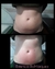 Imagen de Lipolaser de 16 pad.