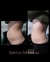 Lipolaser de 16 pad.
